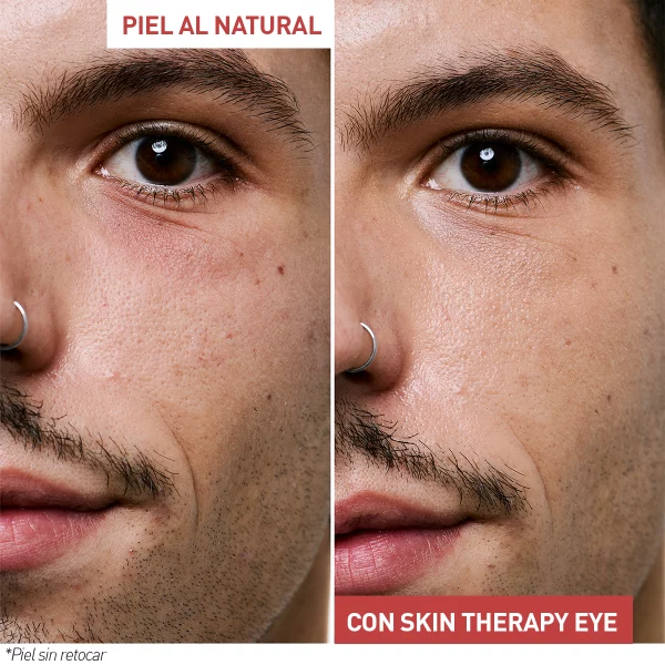 ERBORIAN SKIN THERAPY EYE 15ml - Imagen 3
