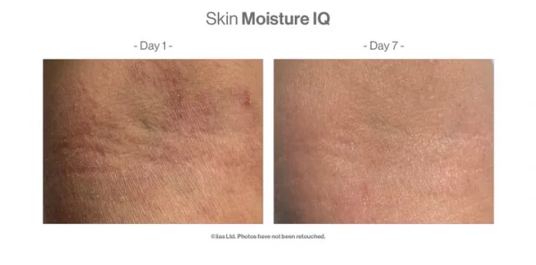 SKIN MOISTURE IQ 28 Días - Imagen 3