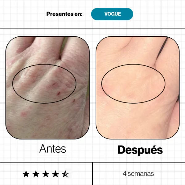 SKIN VIT A+ 60 Cápsulas - Imagen 3